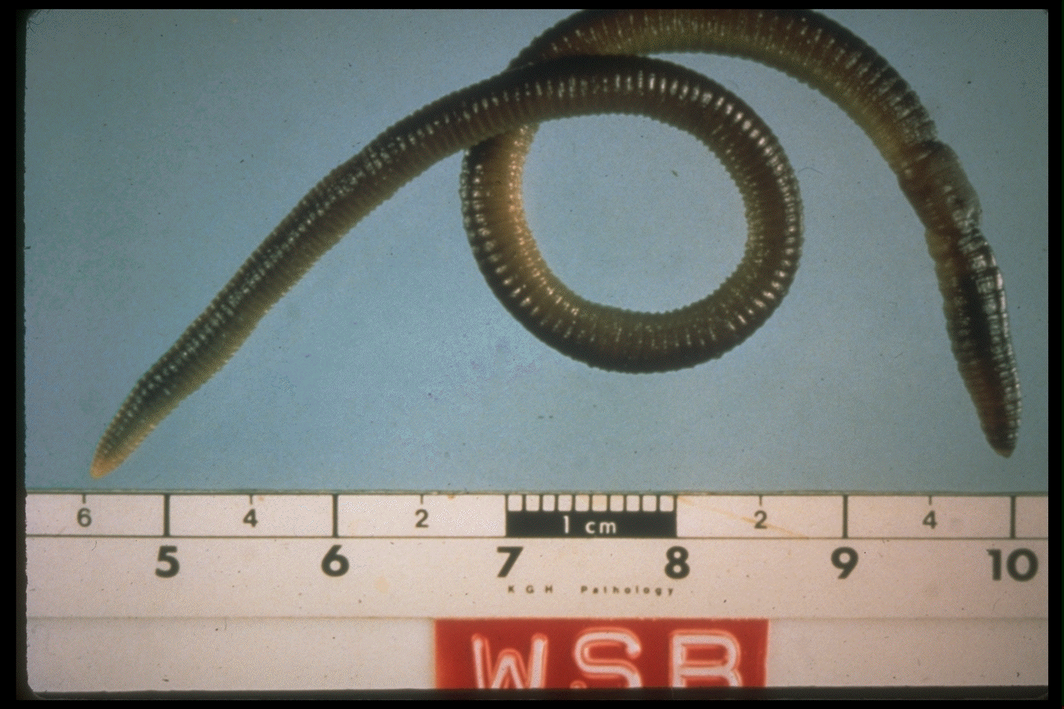 Earthworms